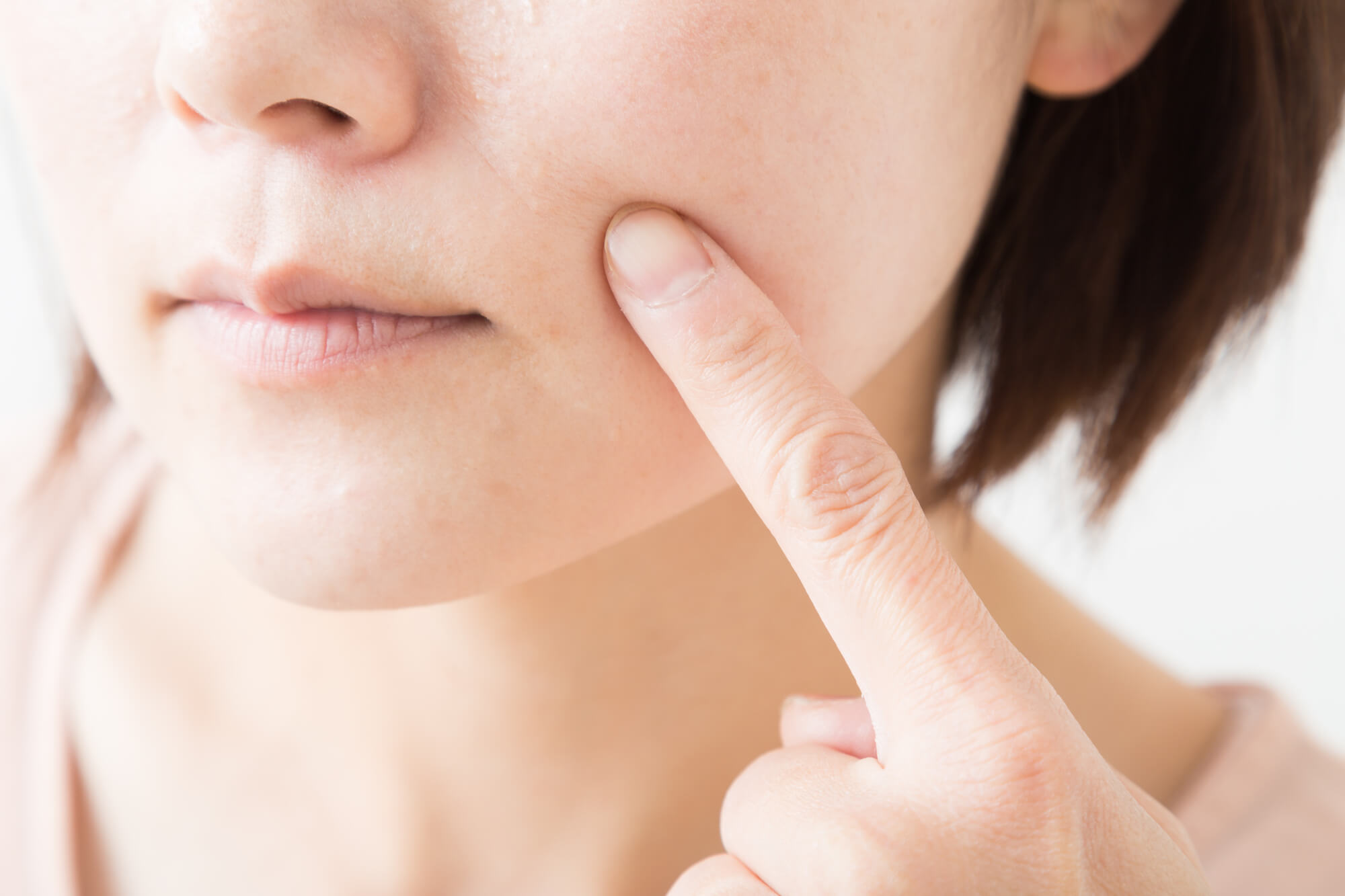 小じわができやすい顔の部位イメージ