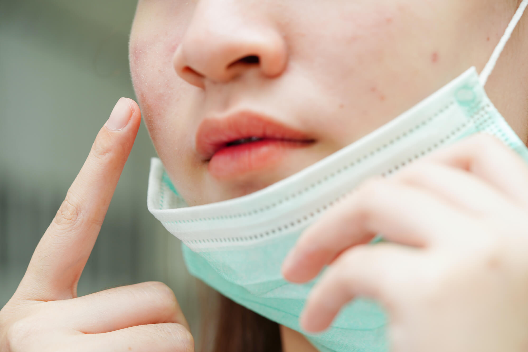 ほうれい線まわりにニキビができる原因イメージ